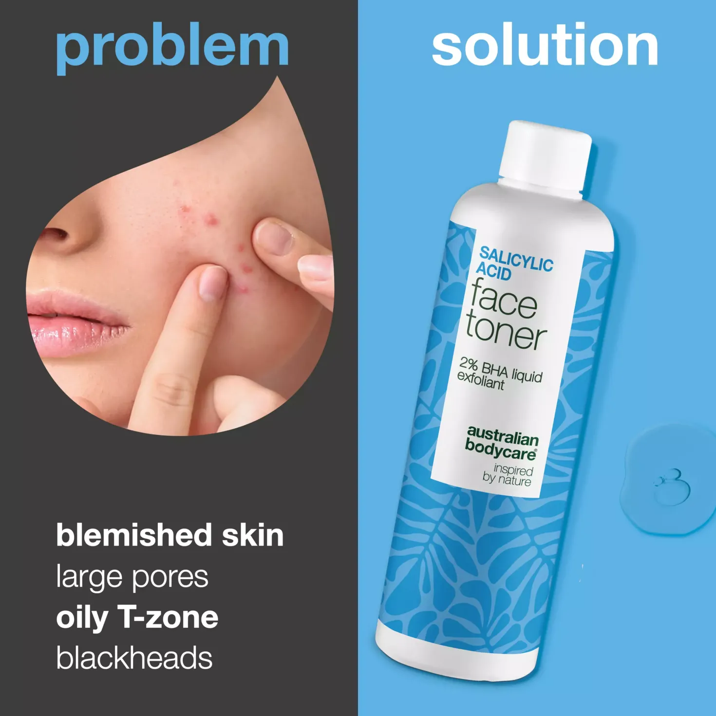 Australian Bodycare Salicylic Acid Face Toner 2% Bha Exfoliant 150 ml