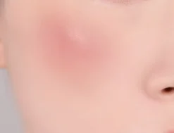 Banila Co Romantic Blush Lip & Cheek 12 Peach Mousse