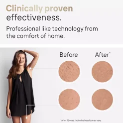 Braun IPL Silk·expert Pro 5 At Home Hair Removal With Pouch Venus Razor 2 Heads PL5152