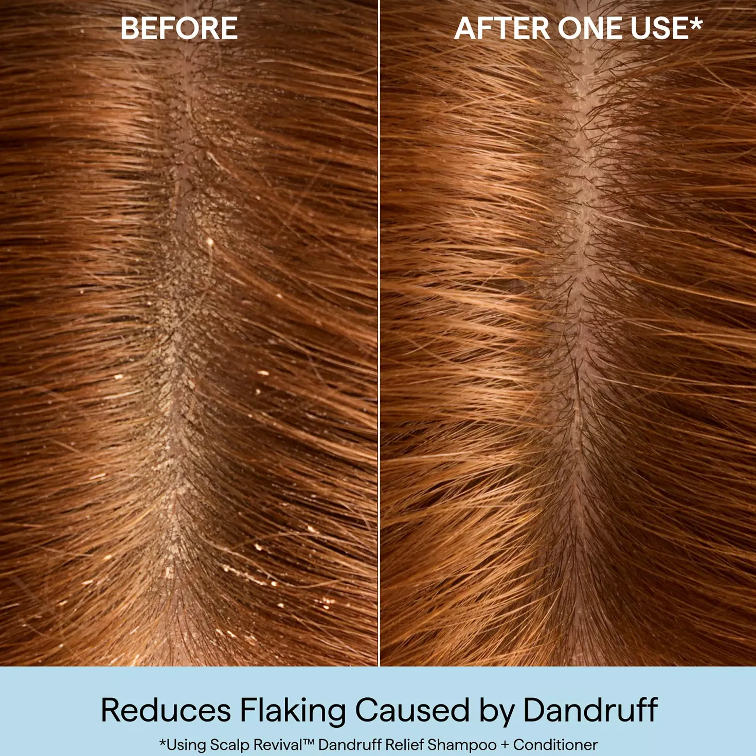 BriogeoScalp Revival™ Dandruff Relief Shampoo 248 ml