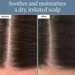 BriogeoScalp Revival™ Rosemary Pre-Wash Oil