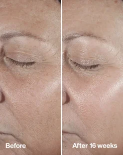 CliniqueSmart Clinical Repair Clinical Repair Wrinkle Correcting Serum 30 ml