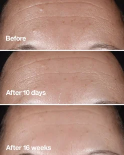 CliniqueSmart Clinical Repair Clinical Repair Wrinkle Correcting Serum 30 ml
