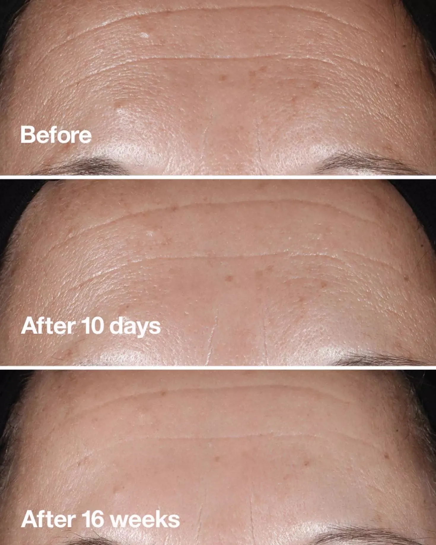 CliniqueSmart Clinical Repair Clinical Repair Wrinkle Correcting Serum 30 ml