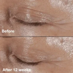 CliniqueSmart Clinical Repair Wrinkle Correcting Eye Cream 30 ml