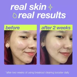 DermalogicaClear Start Breakout Clearing Booster 30 ml