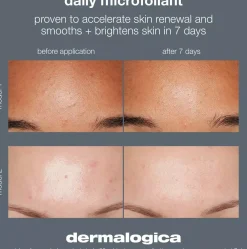 Dermalogica Daily Superfoliant Refill 57 g