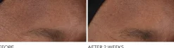 Dr Dennis Gross Advanced Retinol + Ferulic Overnight Wrinkle Treatment 30 ml
