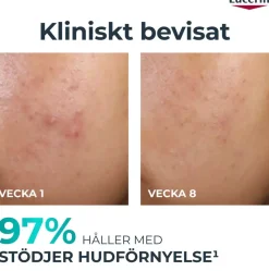 EucerinDermoPure Peeling 11 40 ml