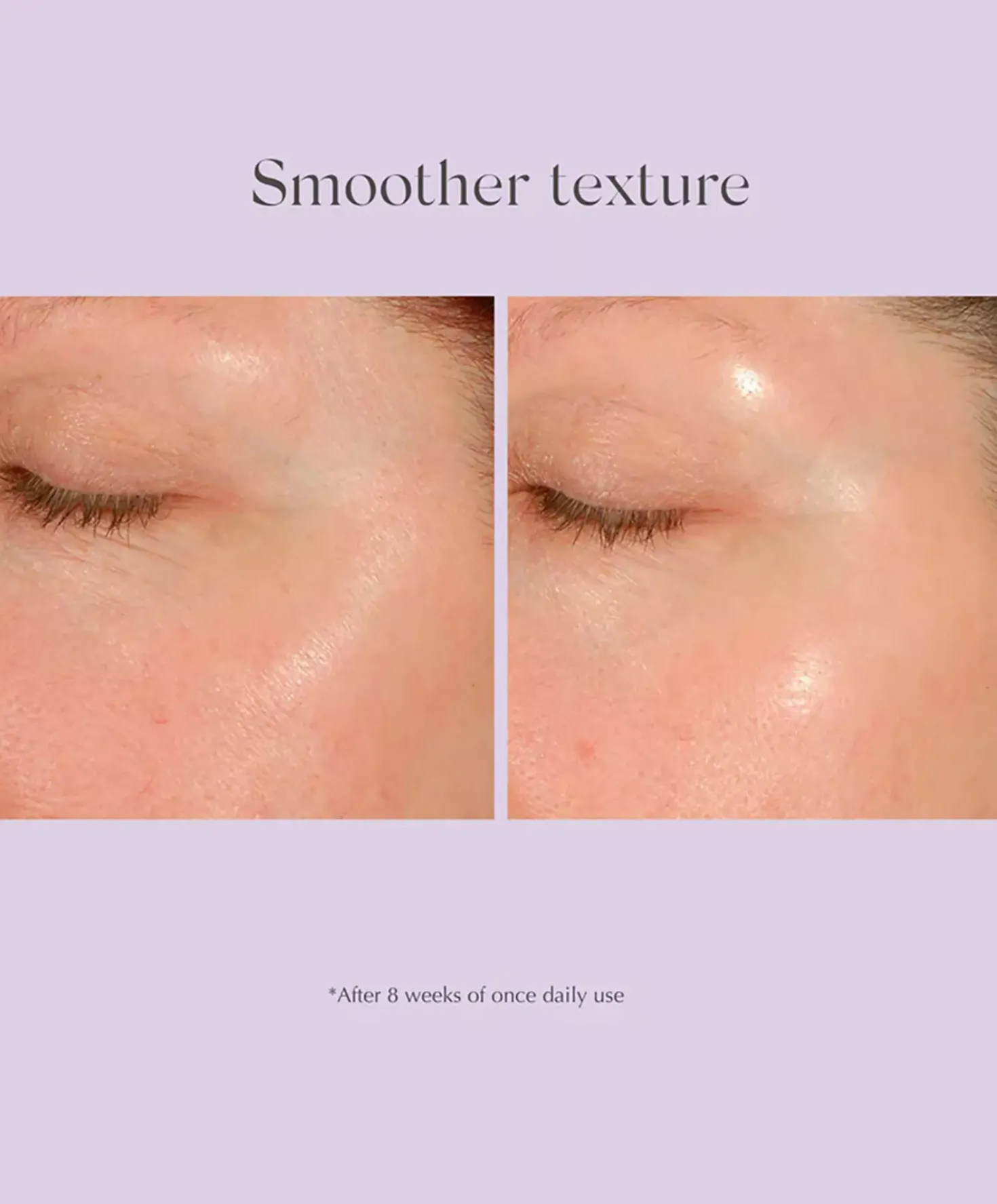Exuviance Daily Resurfacing Peel CA10 58 ml
