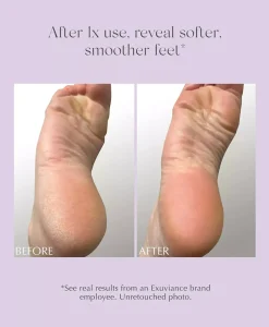 Exuviance Exfoliating & Conditioning Foot Balm 50 g
