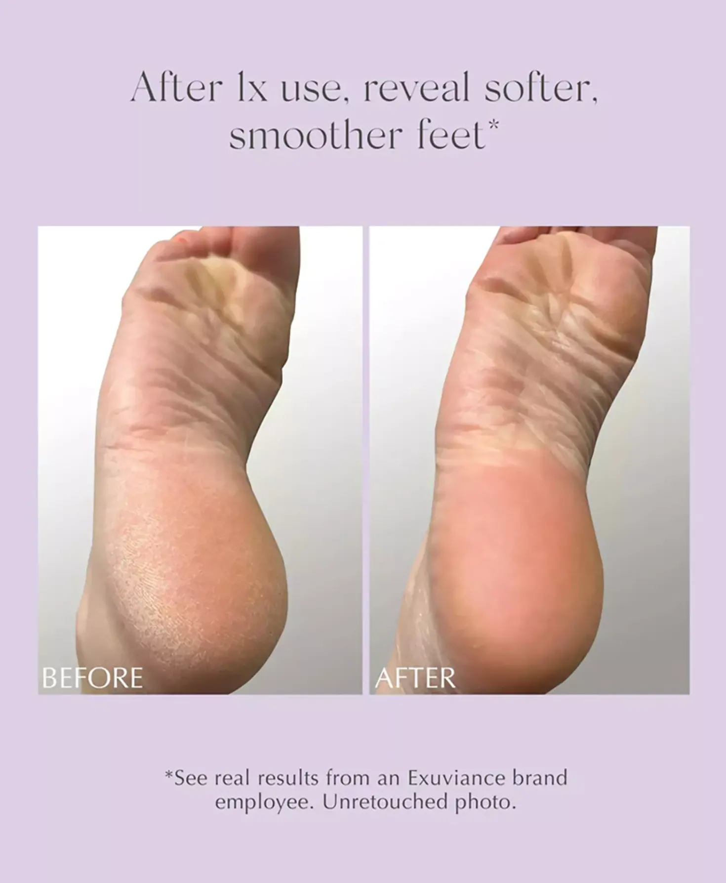 Exuviance Exfoliating & Conditioning Foot Balm 50 g