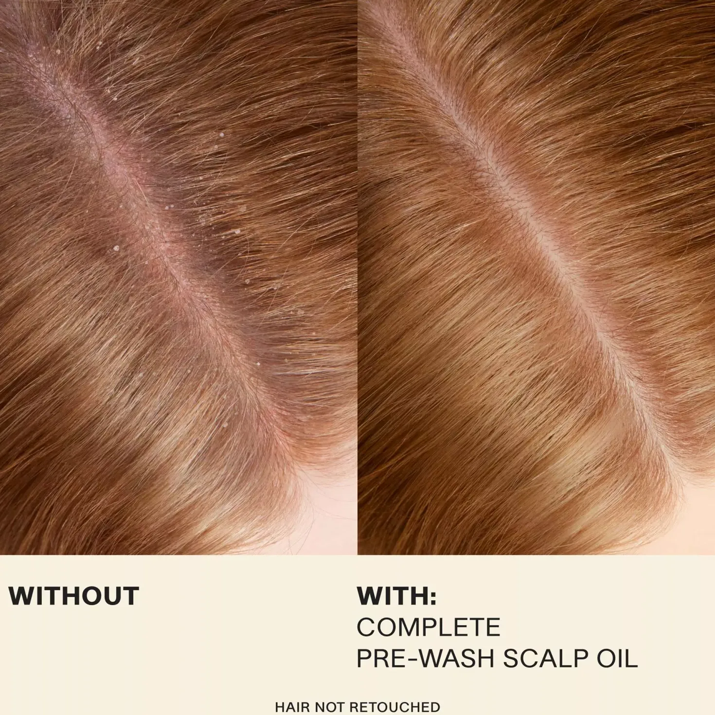 JVN Complete Pre-Wash Scalp Oil 50 ml