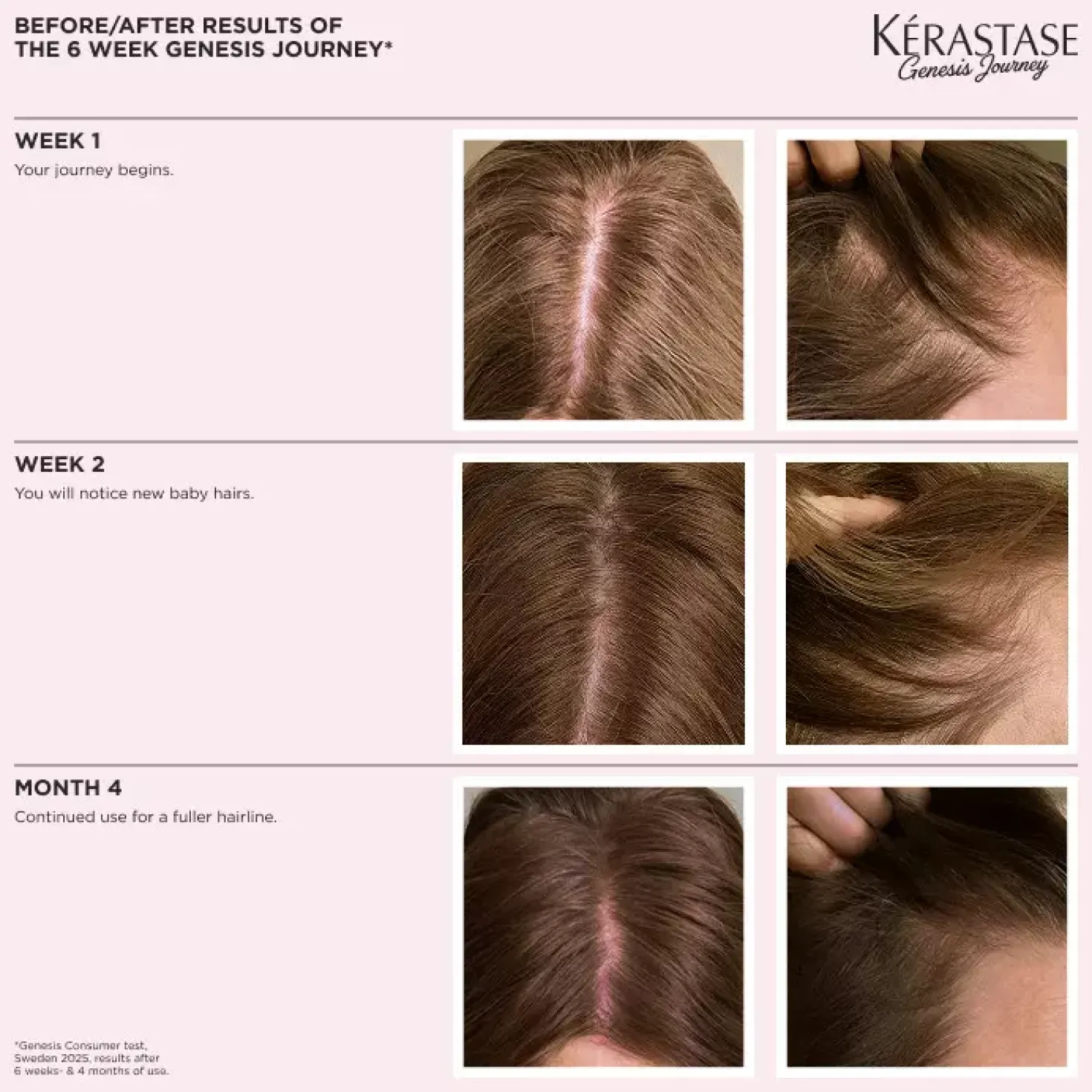 KérastaseGenesis Serum Anti-Chute Fortifiant Scalp Serum 90 ml
