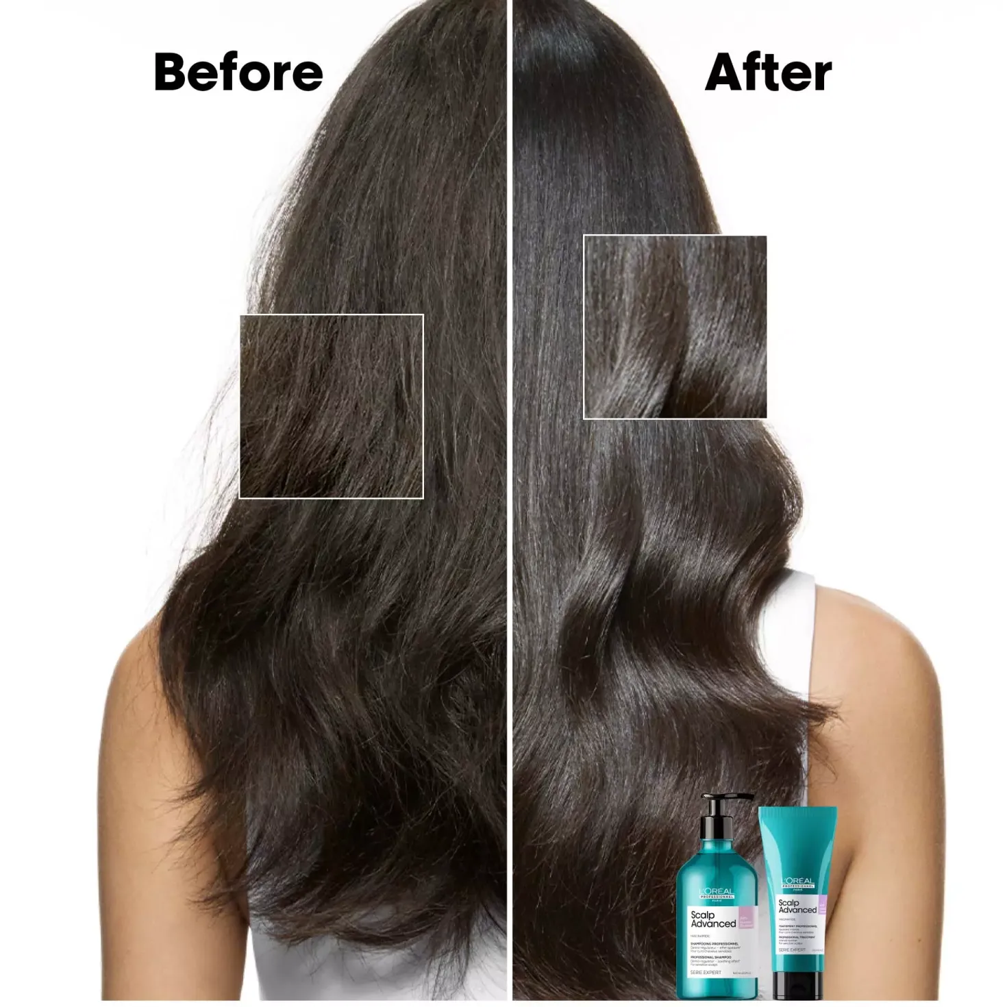 L'Oréal ProfessionnelScalp Advanced Anti-Discomfort Treatment 300 ml