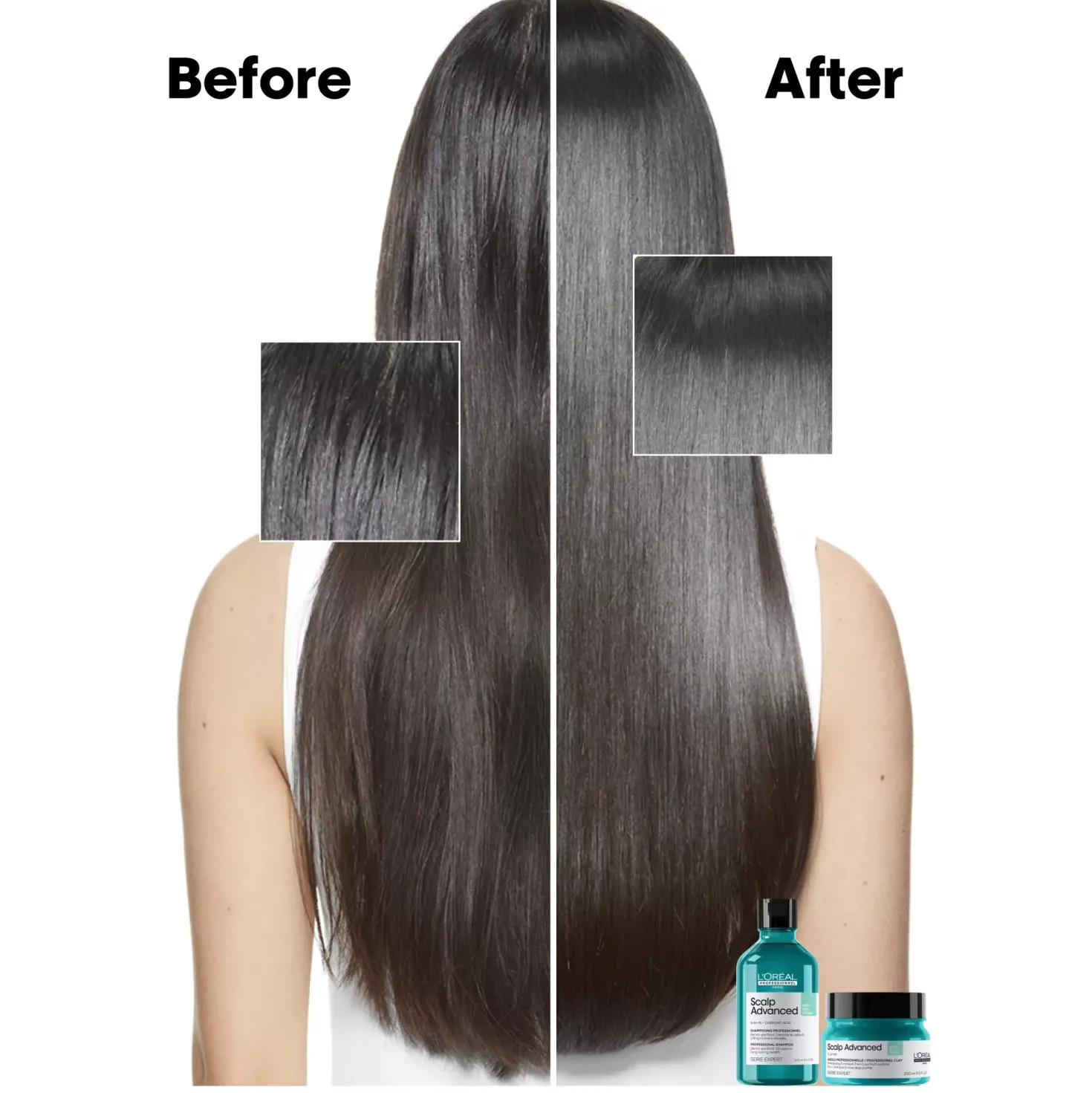 L'Oréal ProfessionnelScalp Advanced Professional Shampoo For Oily Scalp 300 ml