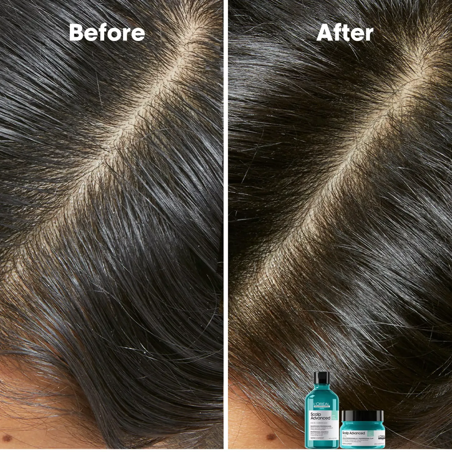 L'Oréal ProfessionnelScalp Advanced Professional Shampoo For Oily Scalp 300 ml