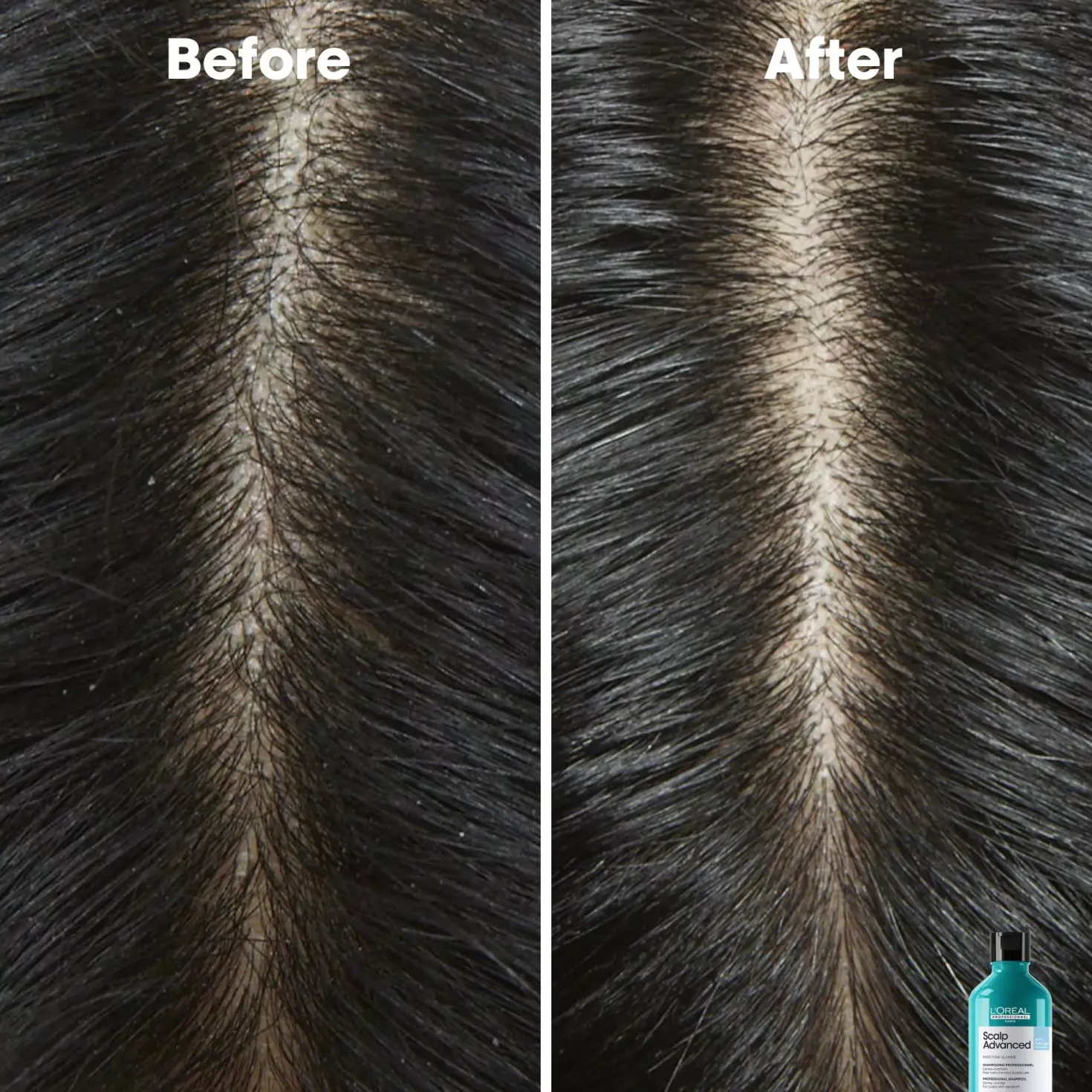 L'Oréal ProfessionnelScalp Advanced Professional Shampoo 300 ml