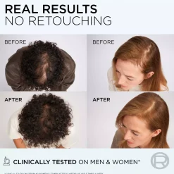 Loreal ParisElvital Growth Booster Hair Serum Against Hair Loss 102 ml