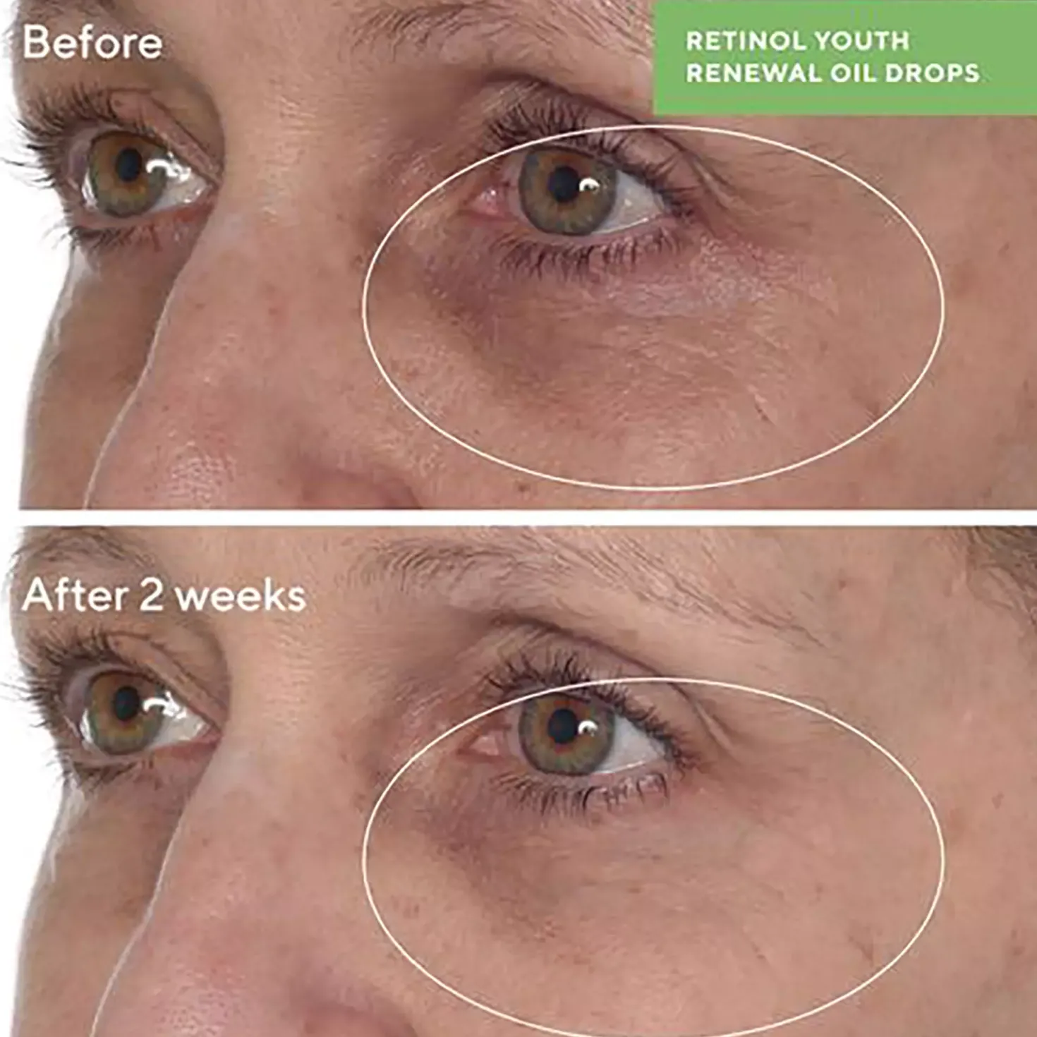 Murad Retinol Youth Renewal Oil Drops 30 ml