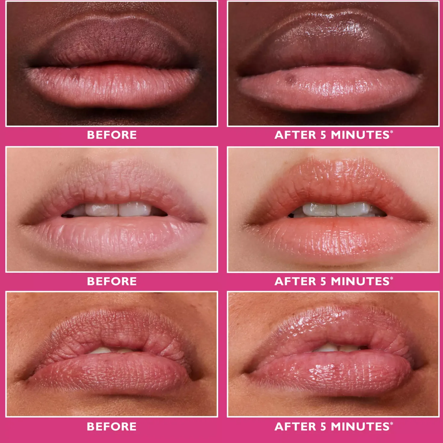 Peter Thomas Roth Instant FIRMx® Lip Filler 10 ml