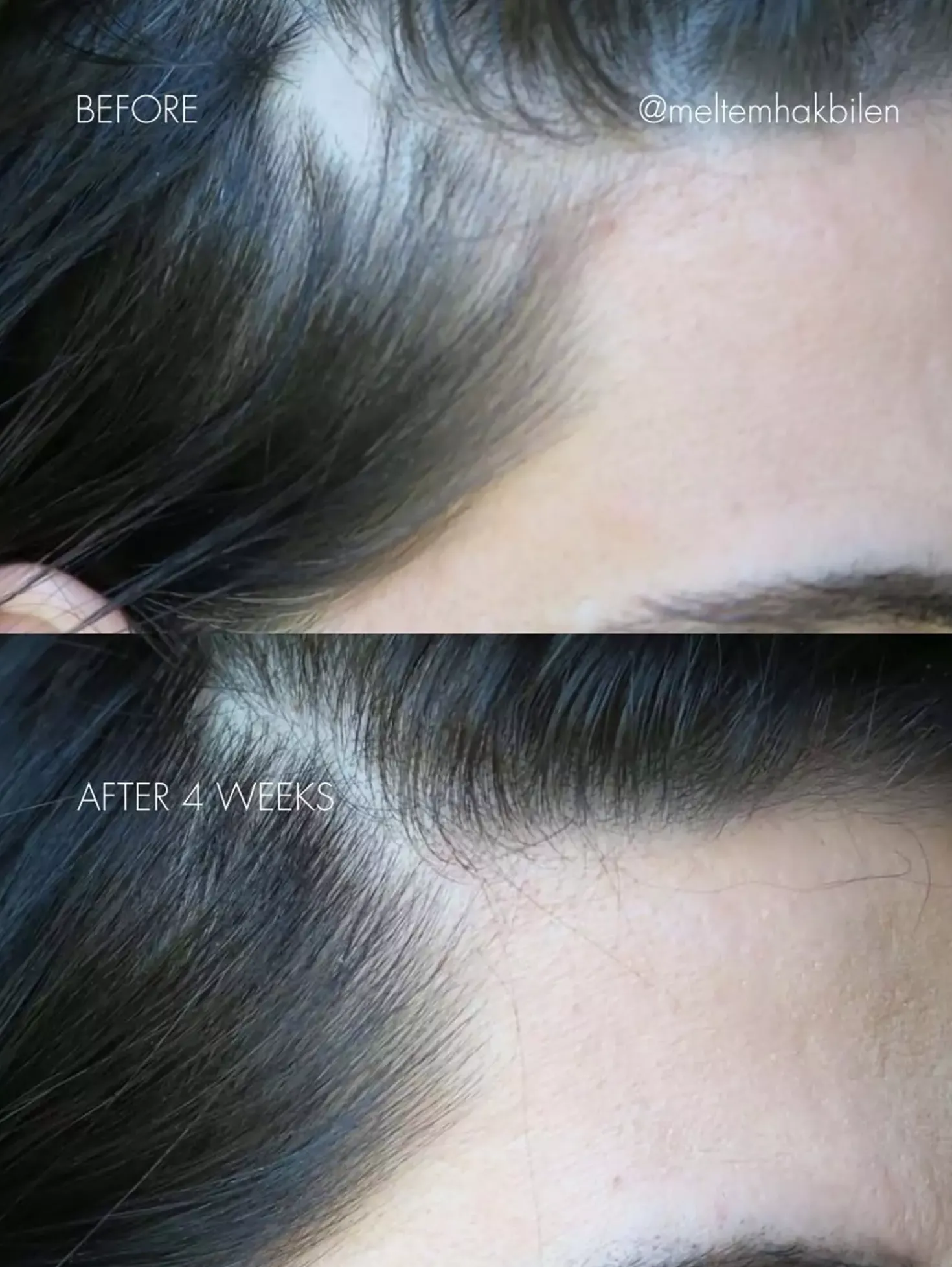 Sweed The Hair Serum 6 ml