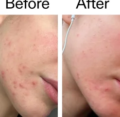 The Inkey List Blemish Clearing Moisturizer 2% Novoretin 50 ml