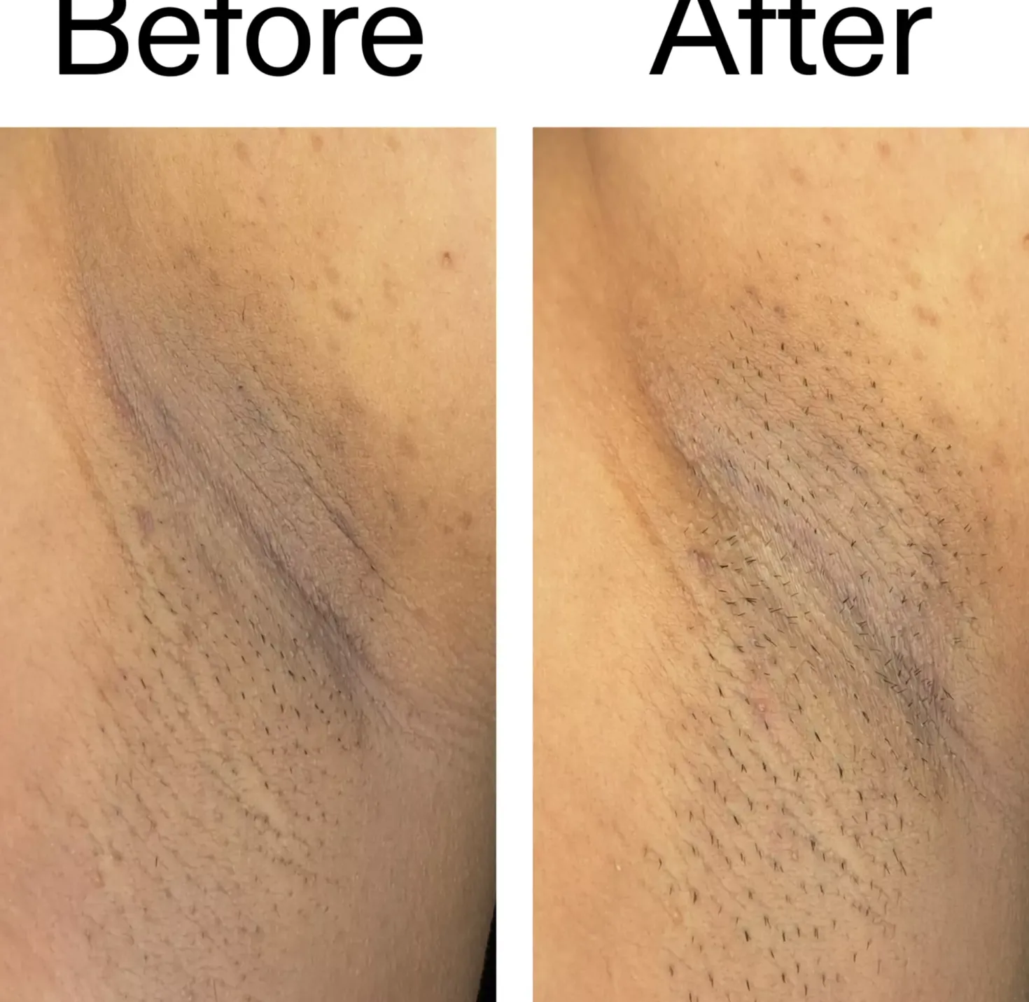 The Inkey List Glycolic Acid Exfoliating Body Stick 45 g