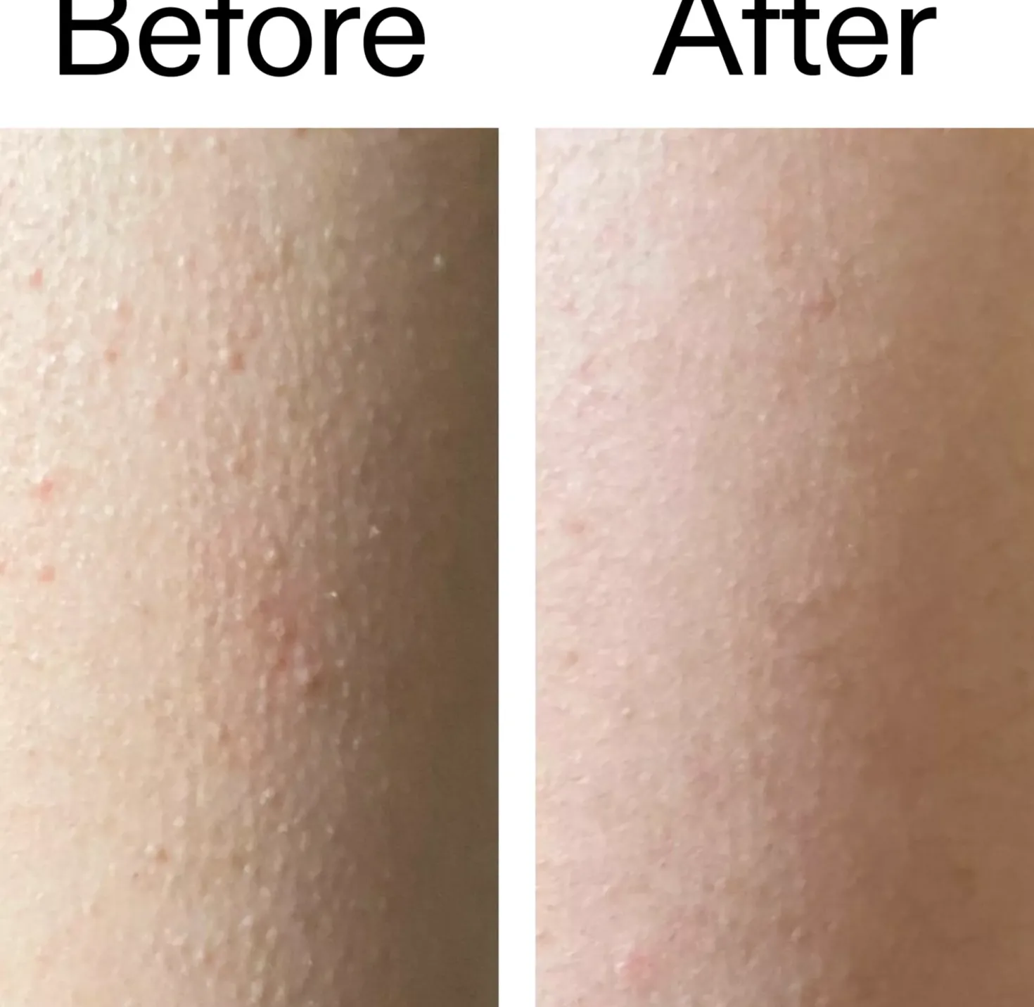 The Inkey List Glycolic Acid Exfoliating Body Stick 45 g