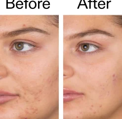 The Inkey List Salicylic Acid Cleanser 150 ml