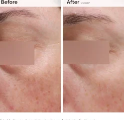 The Ordinary Niacinamide 5% Face & Body Emulsion 100 ml